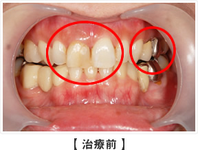 治療前